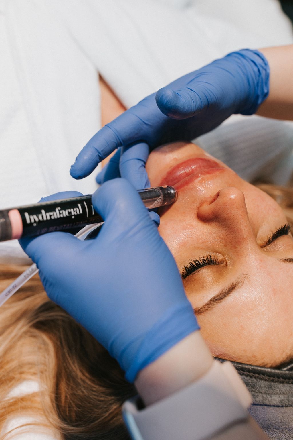 Platinum HydraFacial 4-Pack